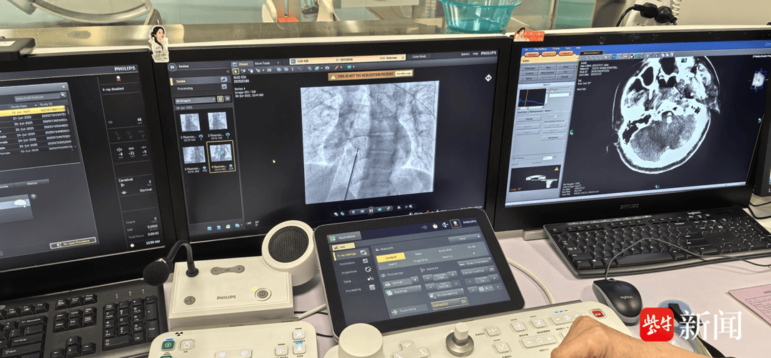 买球的正规网站_36岁青年男性突发脑梗死买球的正规网站，病因竟是心脏上有个“洞”！