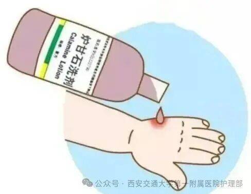 皇冠信用盘_西安多区发现隐翅虫？千万别拍皇冠信用盘！毒液堪比硫酸